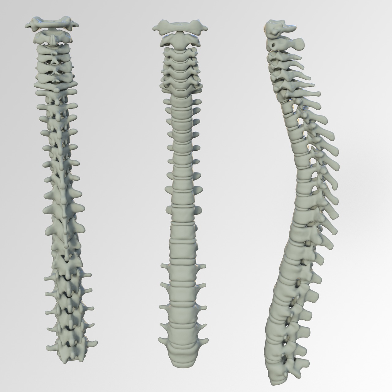 Spinal Screenings  Bakersfield, CA